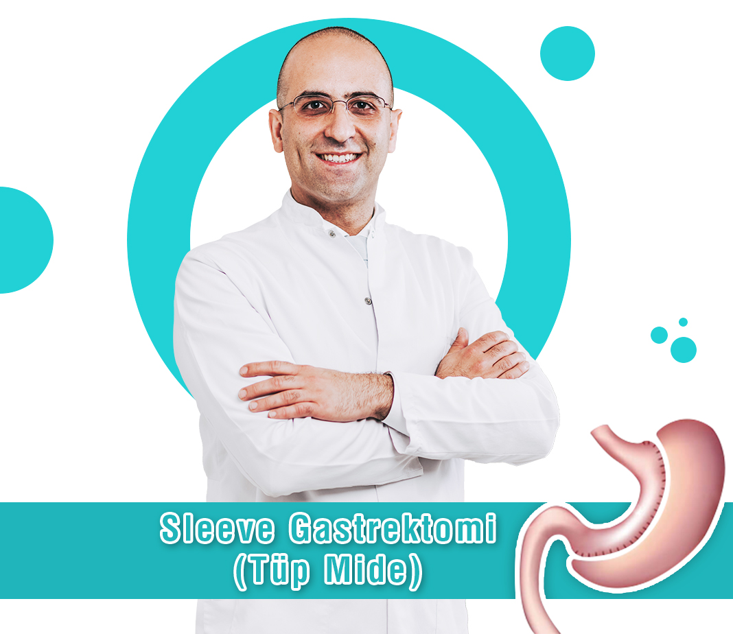 Sleeve Gastrektomi (Tüp Mide)