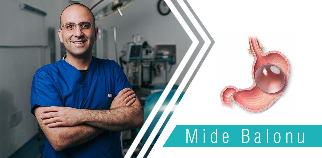 Mide Balonu